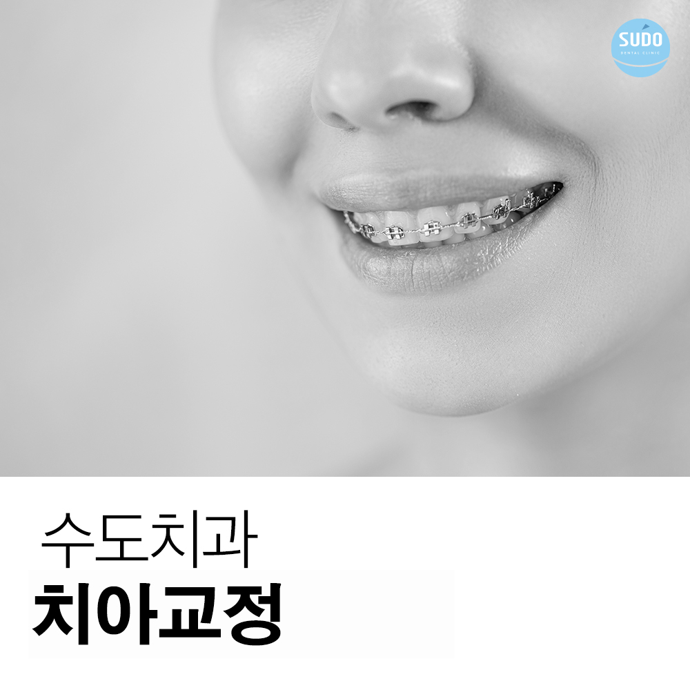 수도치과 치아교정