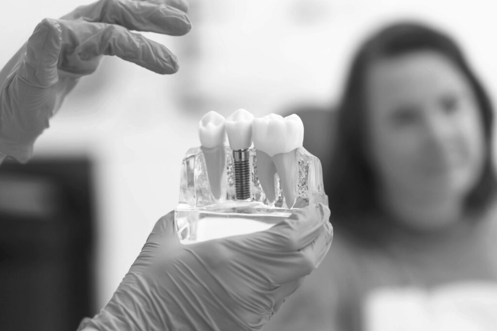 수도치과 임플란트