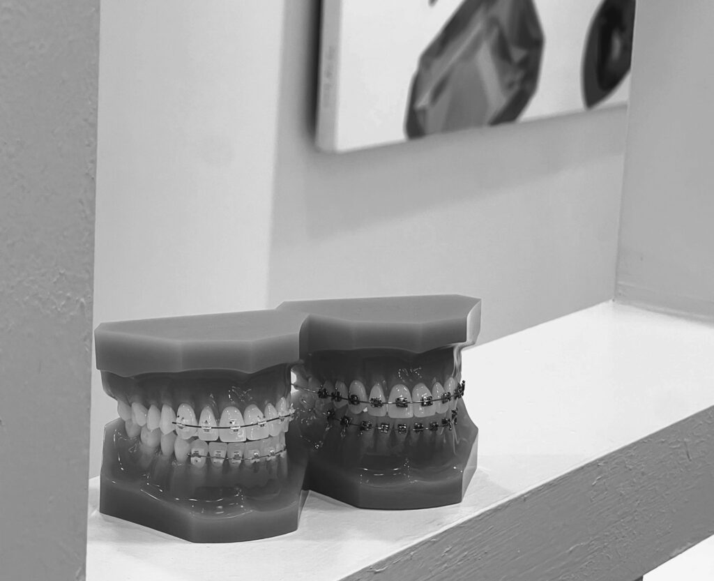 수도치과 치아교정