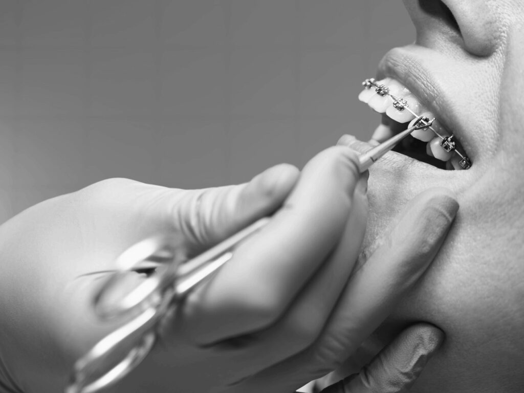 수도치과 치아교정