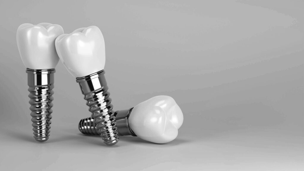 수도치과 임플란트