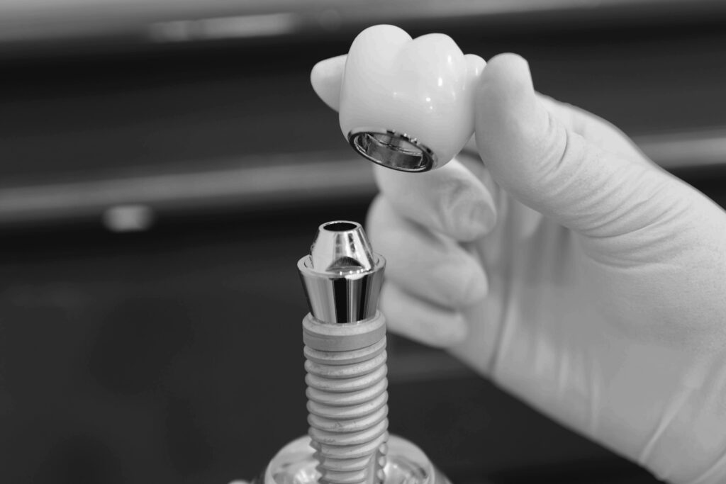 수도치과 임플란트