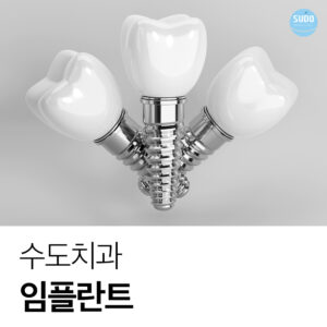 수도치과 임플란트