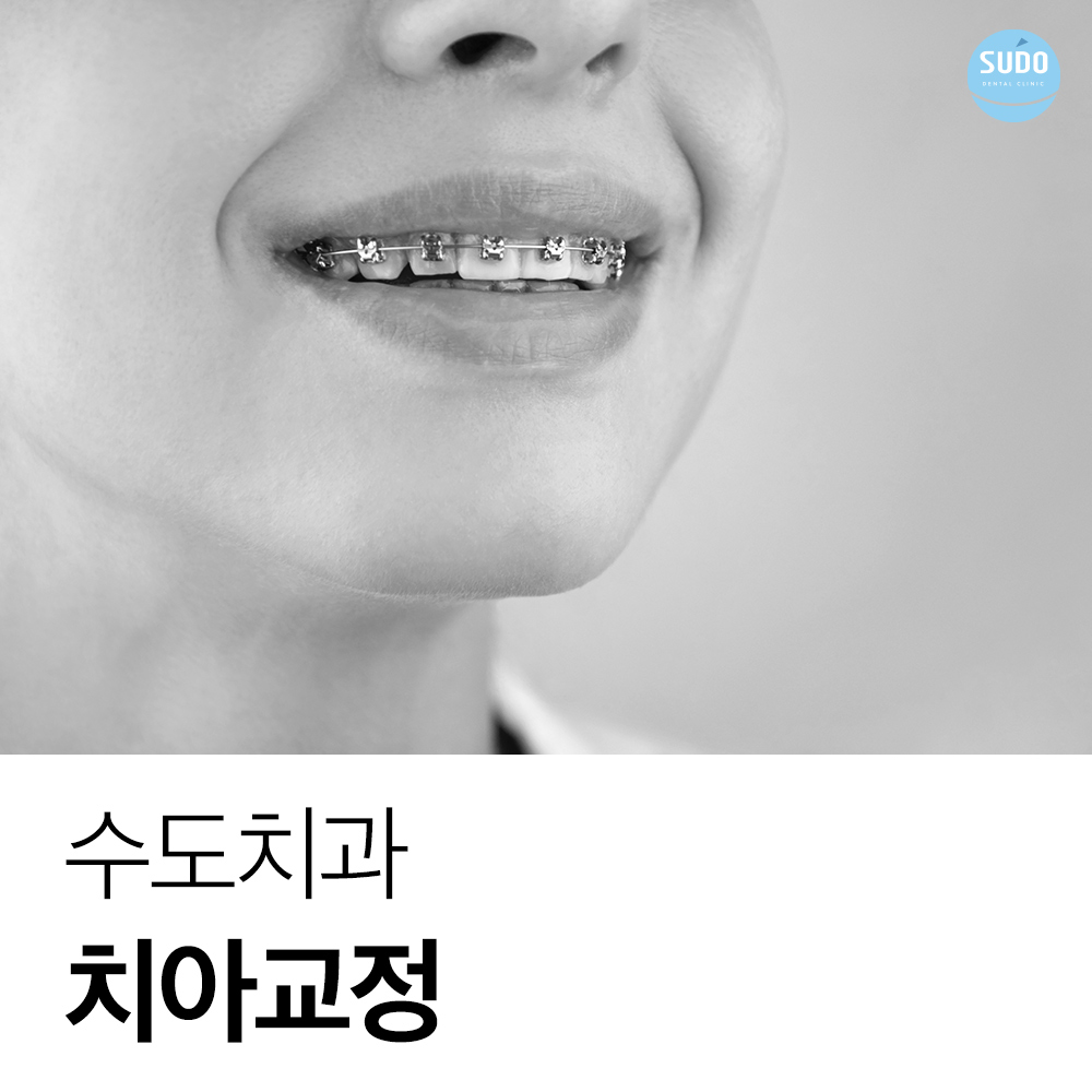 수도치과 치아교정