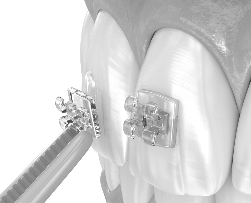 수도치과 치아교정