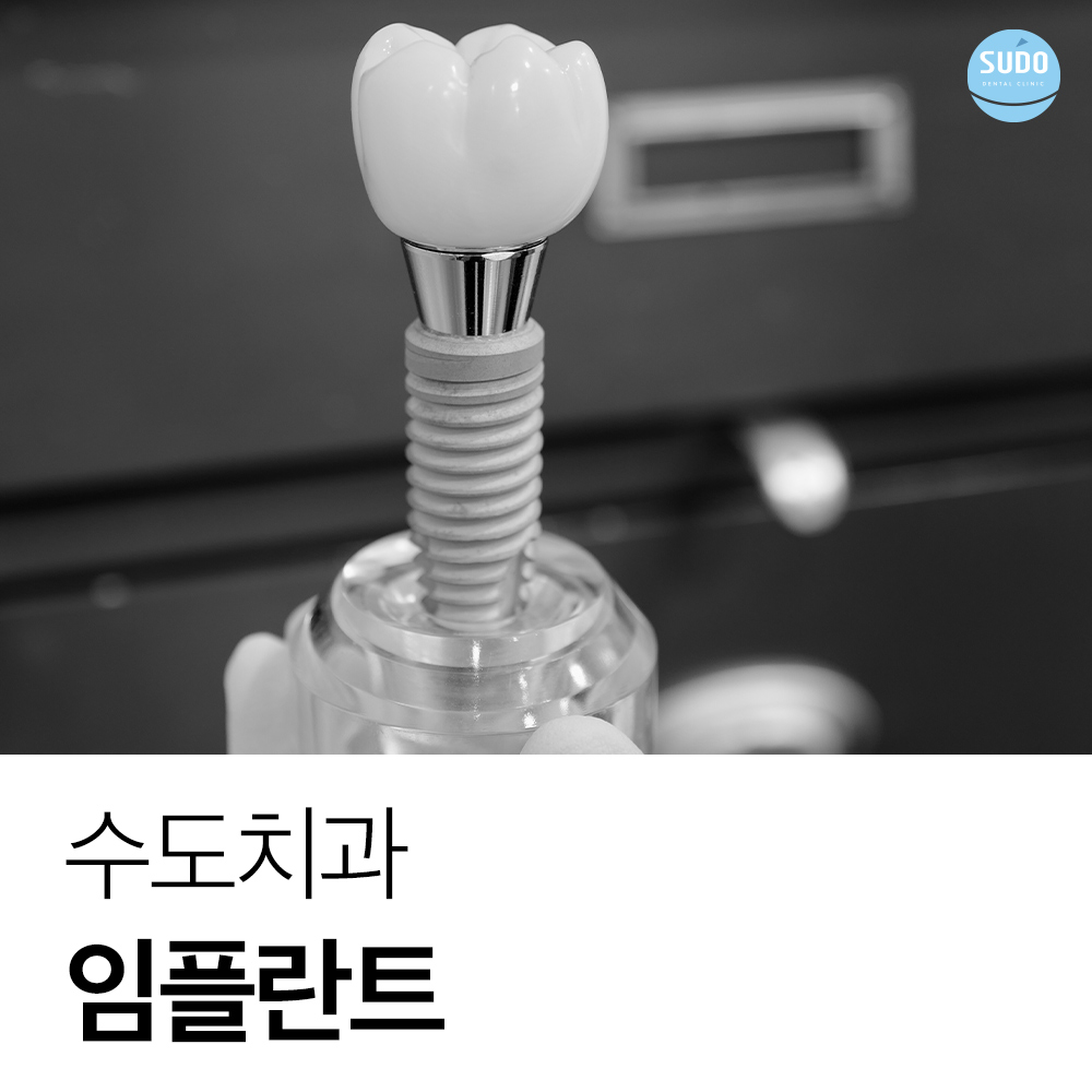 수도치과 임플란트