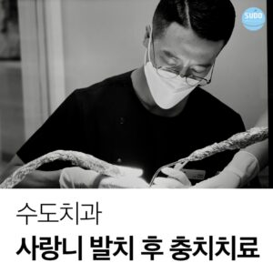 수도치과 사랑니발치 후 충치치료