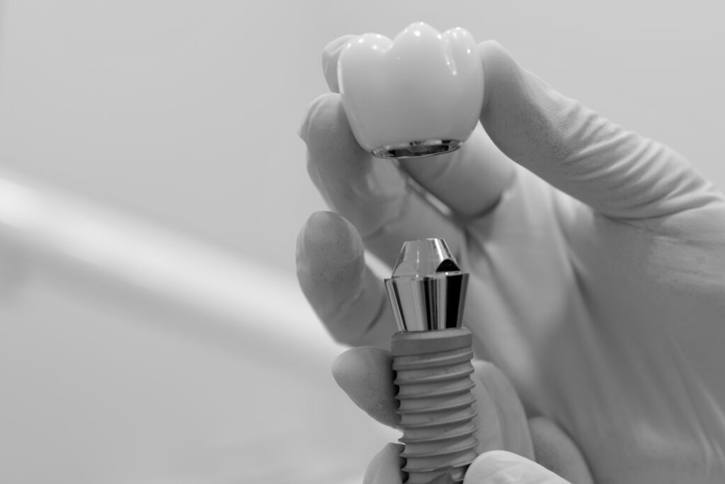 수도치과 임플란트