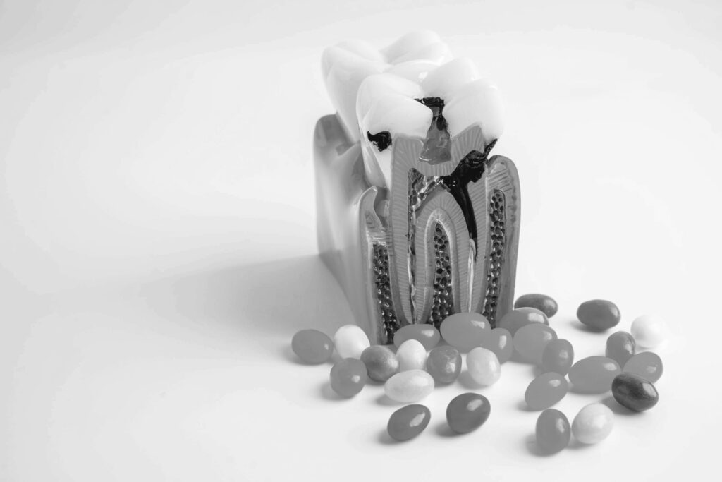 수도치과 충치치료