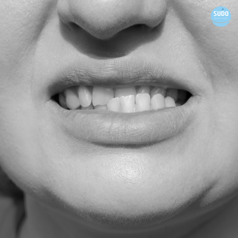 수도치과 턱관절치료