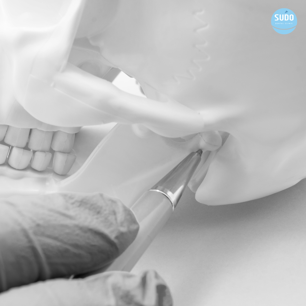 수도치과 턱관절치료