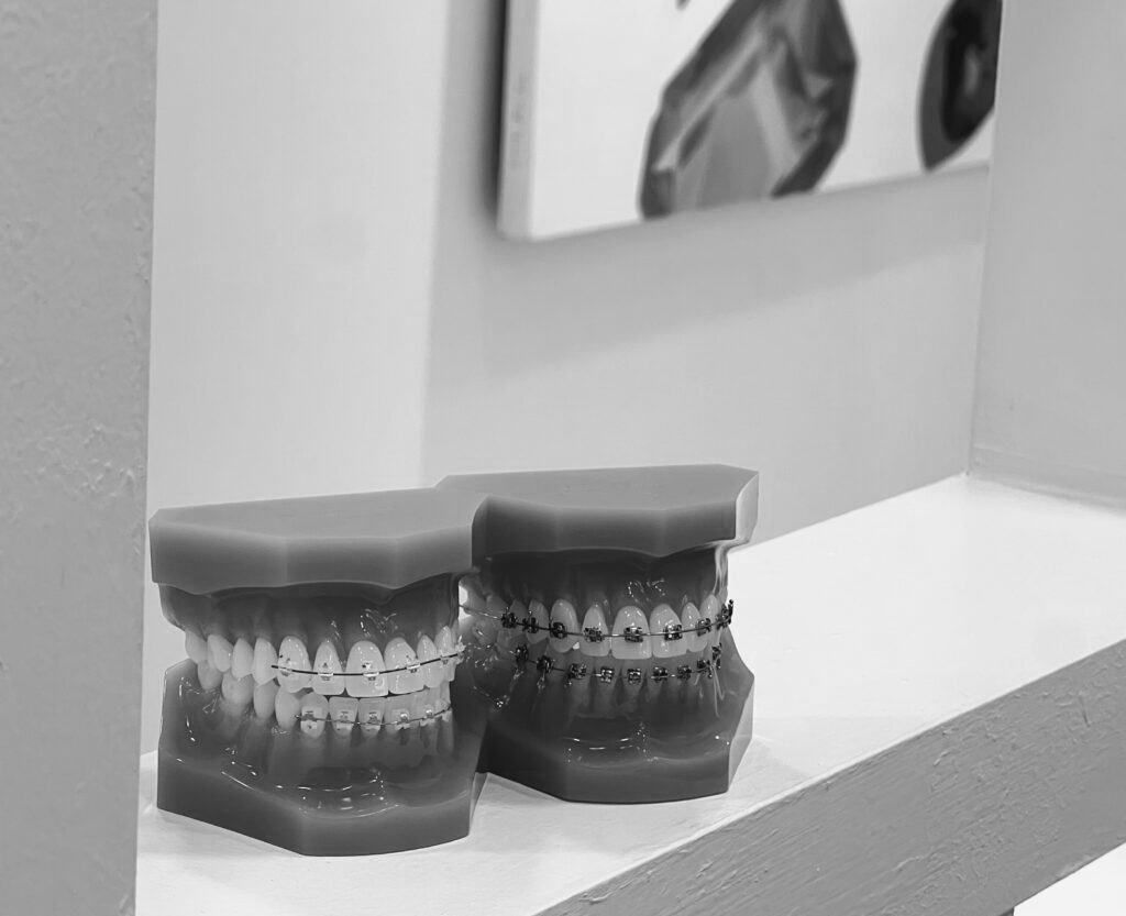 수도치과 치아교정