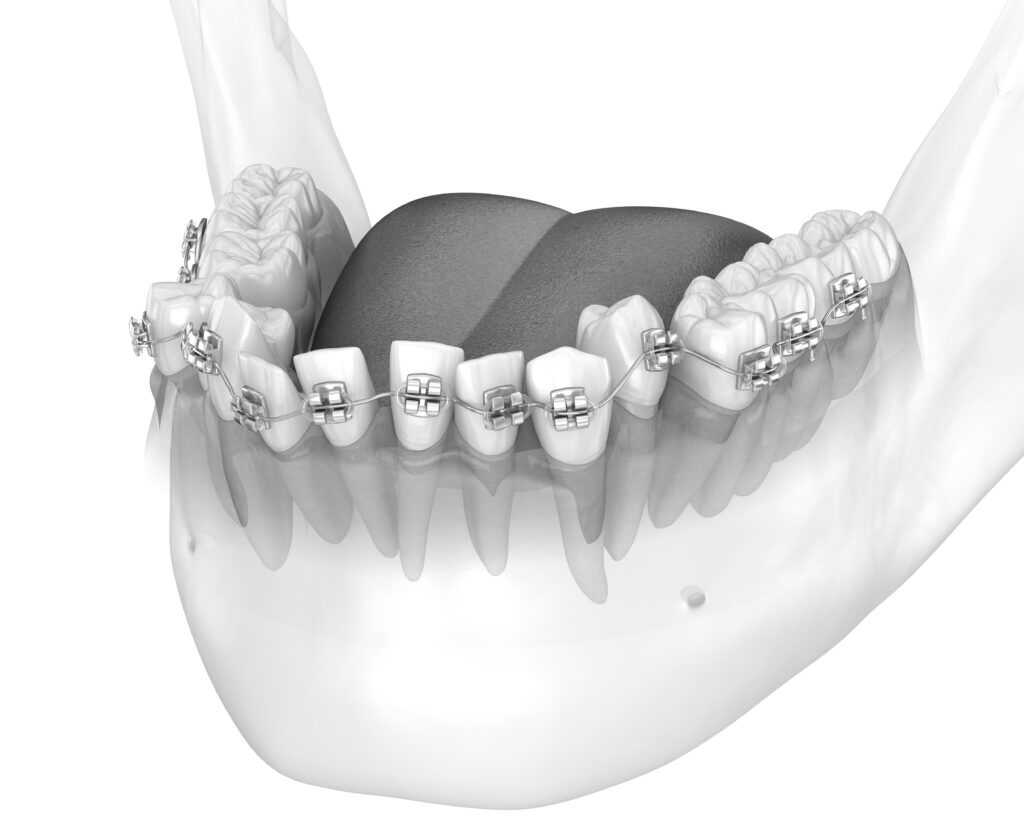 수도치과 치아교정