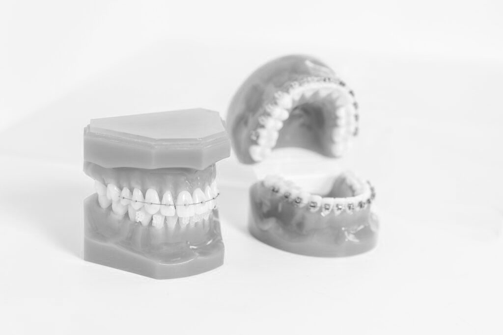 수도치과 치아교정