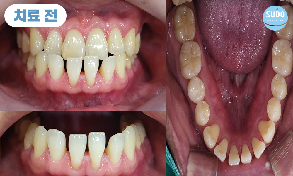 수도치과 치아교정