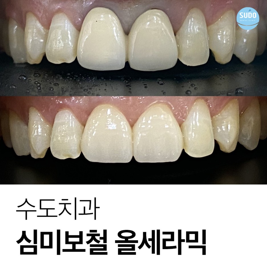부산영도치과