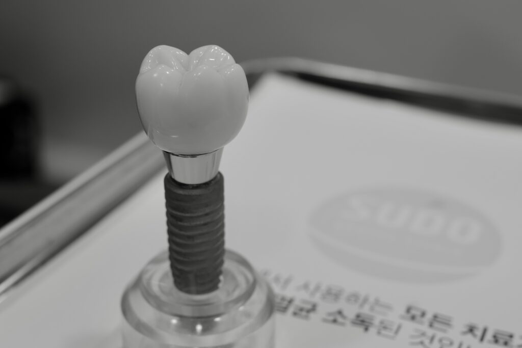 부산영도임플란트