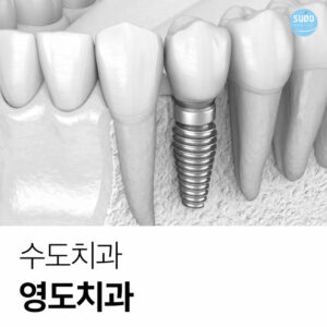 치아가 상실된 부위의 잇몸 상태를 확인하는 초기 상담