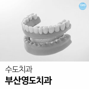 다수 치아 상실로 일반 틀니와 임플란트를 비교하는 부산영도치과 상담 장면